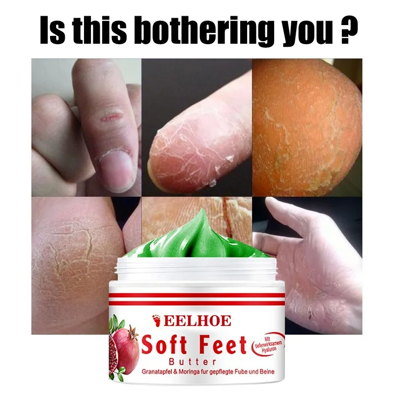 

Hand and Foot Antifreeze Cream to Treat Dry Cracked Skin and Beauty Products, Skin Care and Heel Repair Peeling M8U8