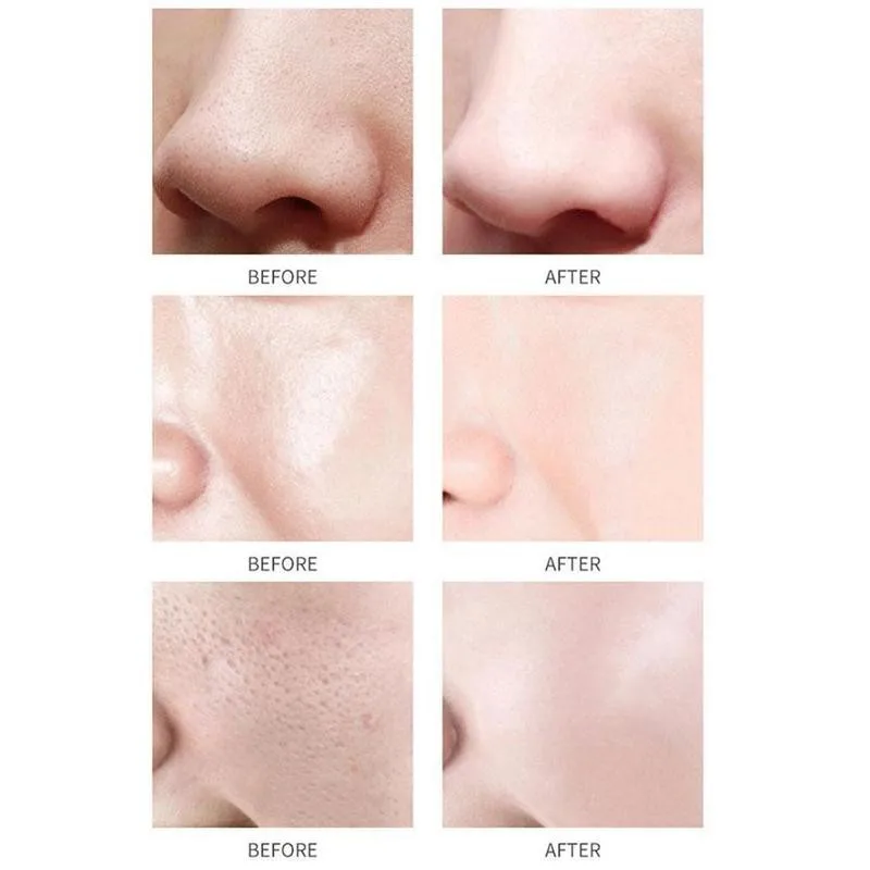 

Mask Cleansing Mud Mask Oil Control Moisturizing Brightening Acne Marks Acne Dispels Gentle Repair Mask Pore U7S6