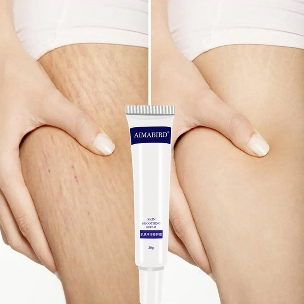 

20g Powerful Remove Pregnancy Scars Cream Stretch Marks Creams Treatment Repair Winkles Firming Body Maternity Anti S9L6