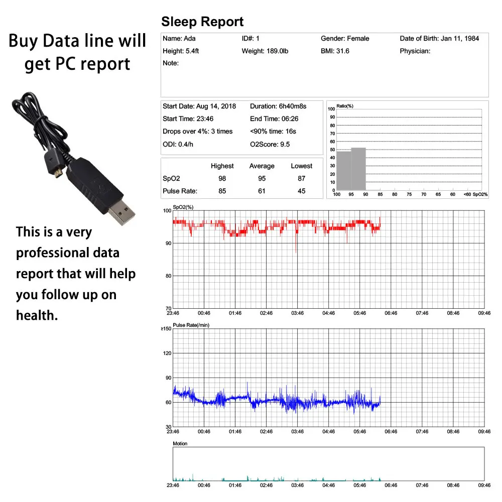 Пульсоксиметр Bluetooth умные наручные часы Портативный OLED монитор сна апноэ