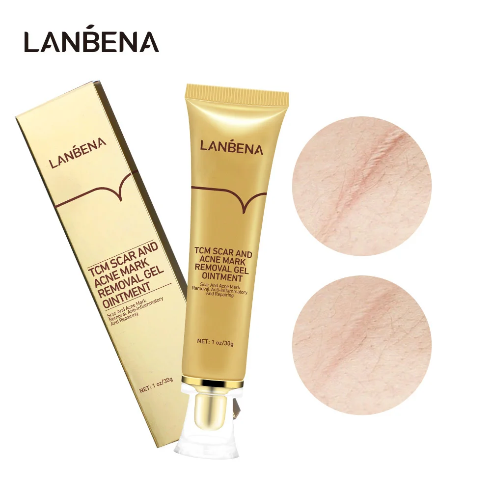 

LANBENA Acne Scar Removal Cream Cosmetics For Face Screm TCM Herbal Repair Stretch Marks Remove Scar Treatment Bioaqua Skin Care