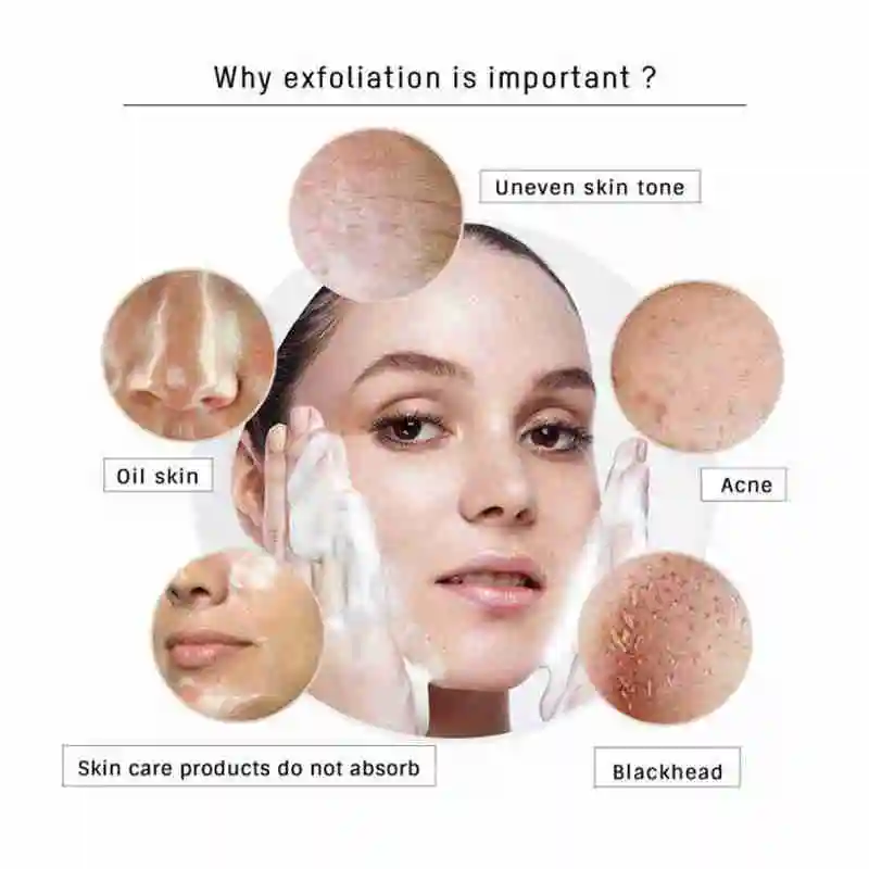 

Aloe Peeling Exfoliating Mousse Moisturizer Cleansing Care Skin Removing Dead Mousse Skin Blackhead Foam M2J9