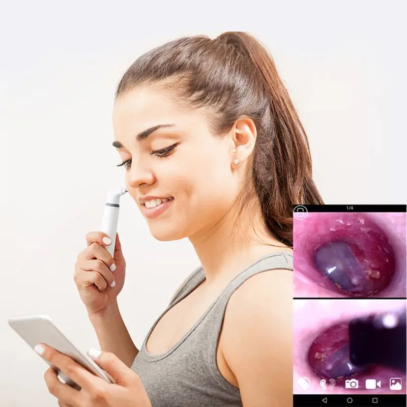 Wifi Smart Otoscope Earscope Cleaner Ear Spoon Earpick 3.9mm Endoscope Camrea | Инструменты