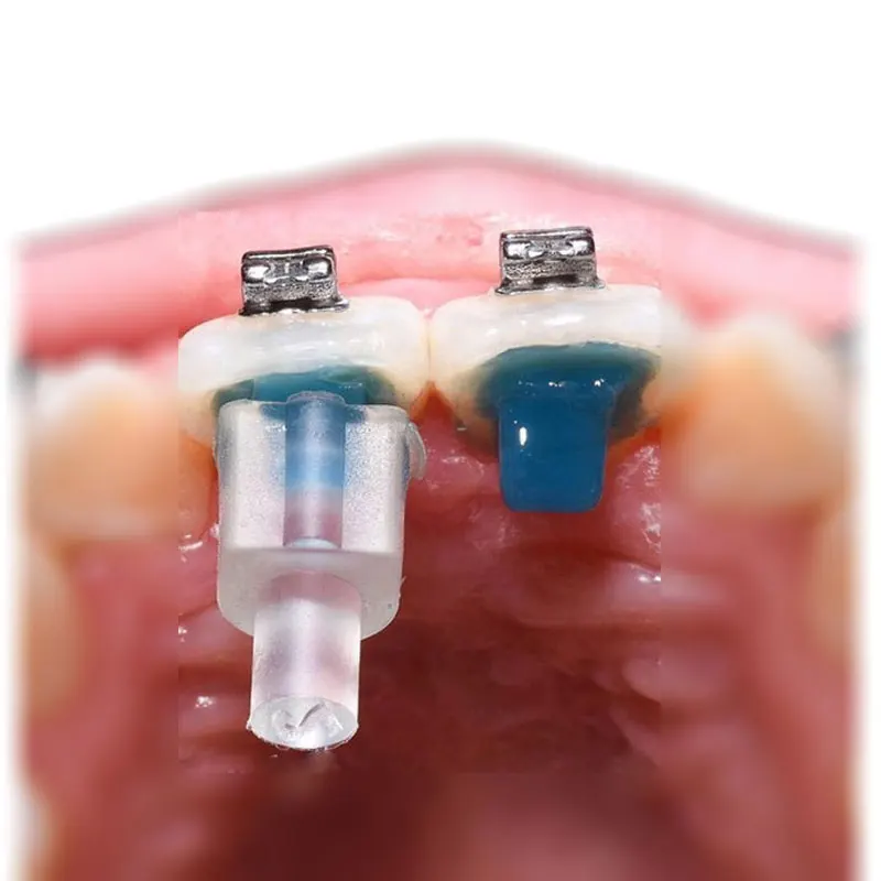 Рисунок 2 - Стоматологические Ортодонтические аксессуары