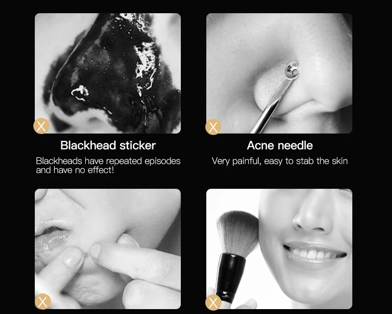 Ultrasonic Facial Skin Cleaning Device Scrubber USB Pore Cleanser Exfoliator 4 Modes Anion Machine for Care | Красота и здоровье