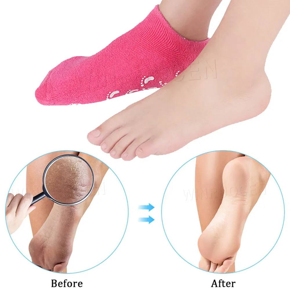 Силиконовые вставки для отшелушивающих отбеливающих носков мужчин и