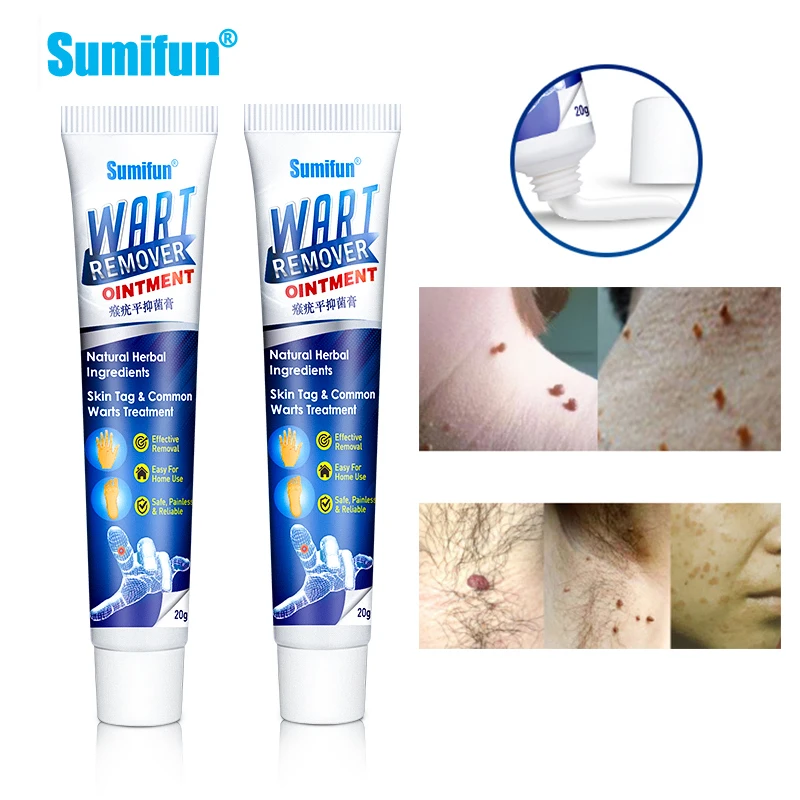 

1pcs 20g Herbal Extract Warts Remover Ointment Wart Treatment Cream Skin Tag Remover Corn Plaster Antibacterial Warts Ointment