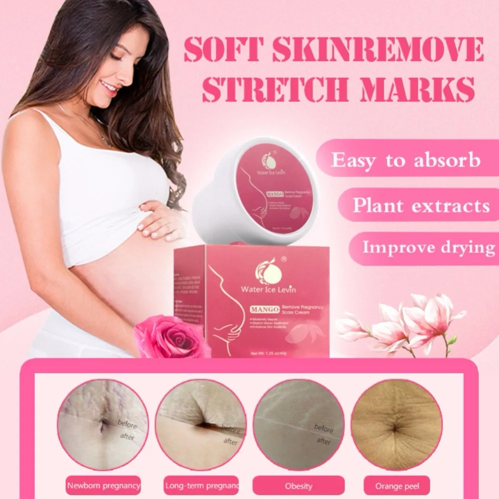 

Marks Remove Pregnancy Scar Maternity Smooth Skin Creams New Natural Pure Powerful Stretch Body Repair Cream