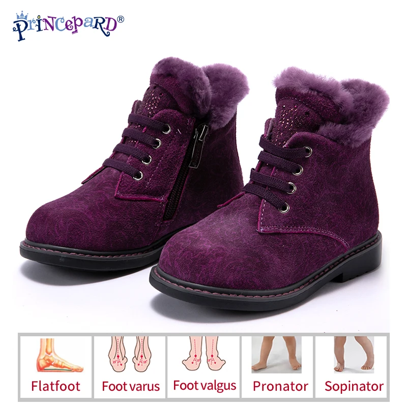 Princeprd новые зимние детские ортопедические ботинки 100% натуральный мех