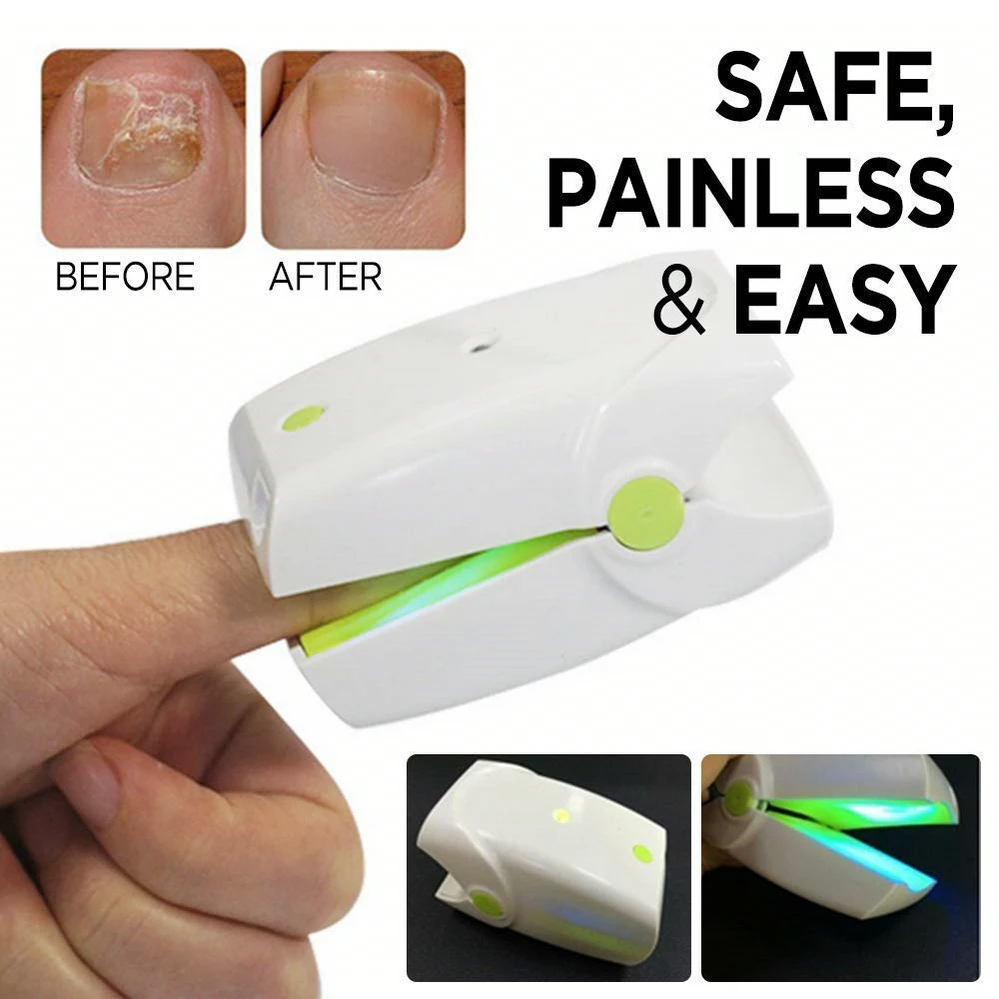 Diode Low Level Laser Therapy LLLT Nail Fungus Onychomycosis Treatment Device Instrument Anti Fungal Rechargeable Home Use