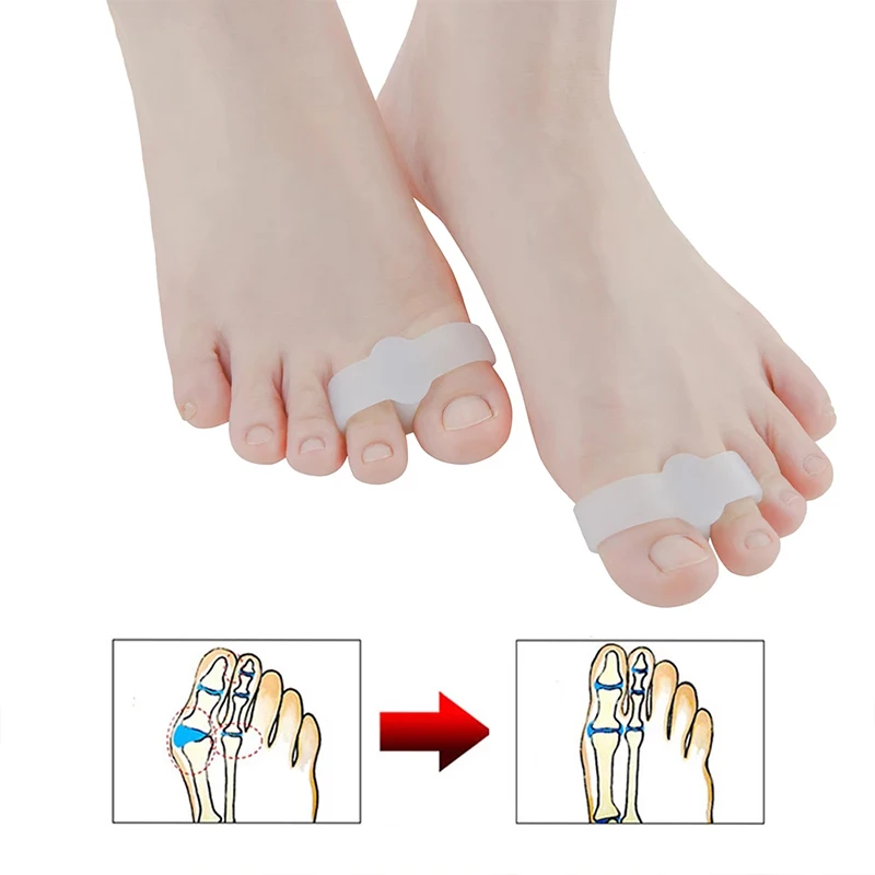 

2pcs=1pair Silicone Toe Spreader Separator Bunion Hallux Valgus Corrector Thumb Finger Correction Straightener Foot Care Tool
