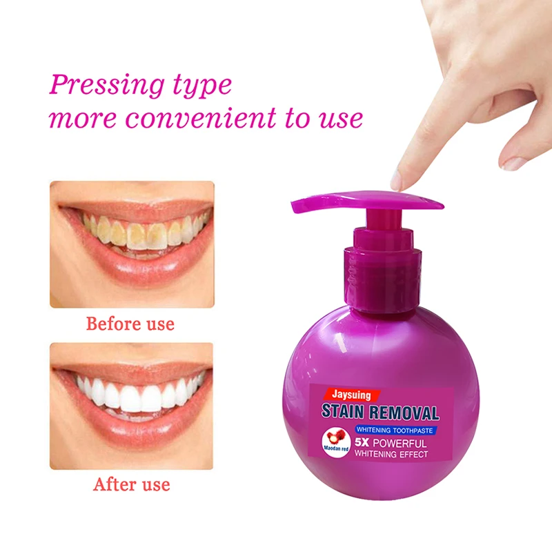 Пищевая Сода фруктовый аромат отбеливающая зубная паста с ручным прижимом