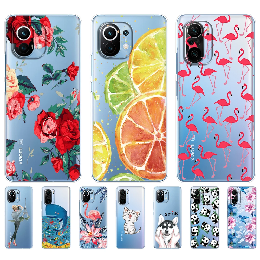 For xiaomi Mi 11 | Mi 11 Lite 4G 5G NE Mi 11i | Mi 11 Ultra Case Back For xiaomi11 i 11Lite Phone Cover Mi11Lite Silicon TPU