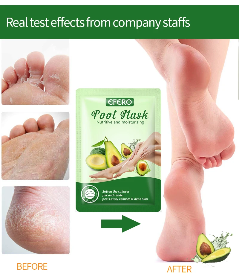 3 пары отбеливающие увлажняющие носки для ног|Стопы| |