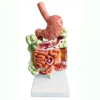 human digestive system stomach anatomy large intestine cecum rectum duodenum human internal organs structure medical model