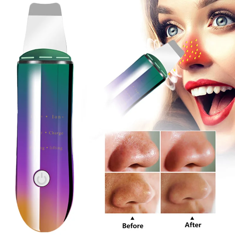 

Скребок ультразвуковой для пилинга лица, аппарат для глубокой очистки пор, от черных точек и ионов, паровой