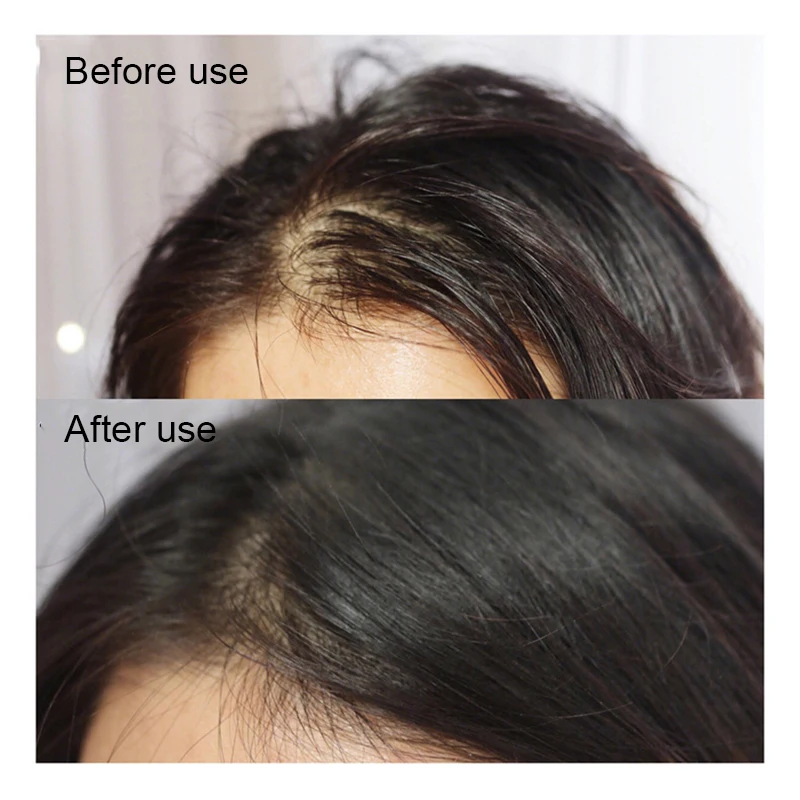 Эссенция для роста волос растительные экстракты питательное эфирное масло