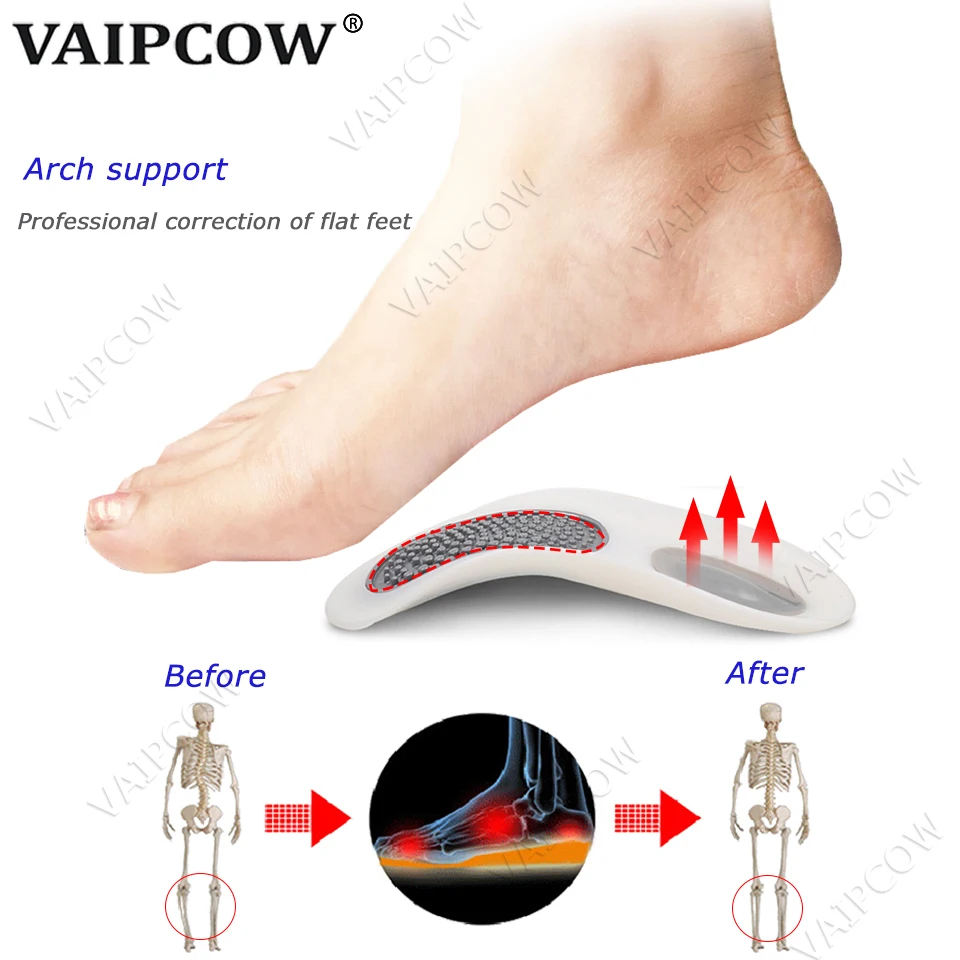 Flatfoot Orthotics Cubitus Varus Orthopedic Insoles for Falt Feet Pads Arch Support Orthopedic Cushion Massage insert Orthotic