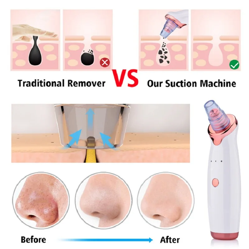 Facial care Blackhead Remover Skin Care Pore Vacuum Acne Pimple Removal Suction Tool Diamond Dermabrasion Machine | Красота и