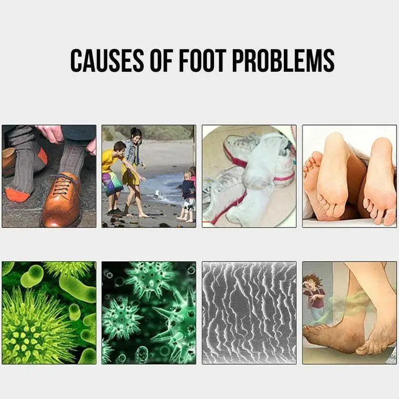 Антибактериальный зуд для стоп снижающий от пота и мозолей вонючий запах беририс