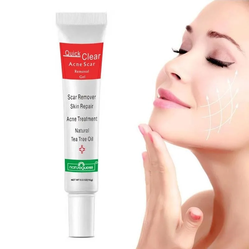 

15g Acne Treatment Cream Scar Removal Blackhead Repair Gel Oil Control Shrink Pores Whitening Skin Care Beauty Acne Cream