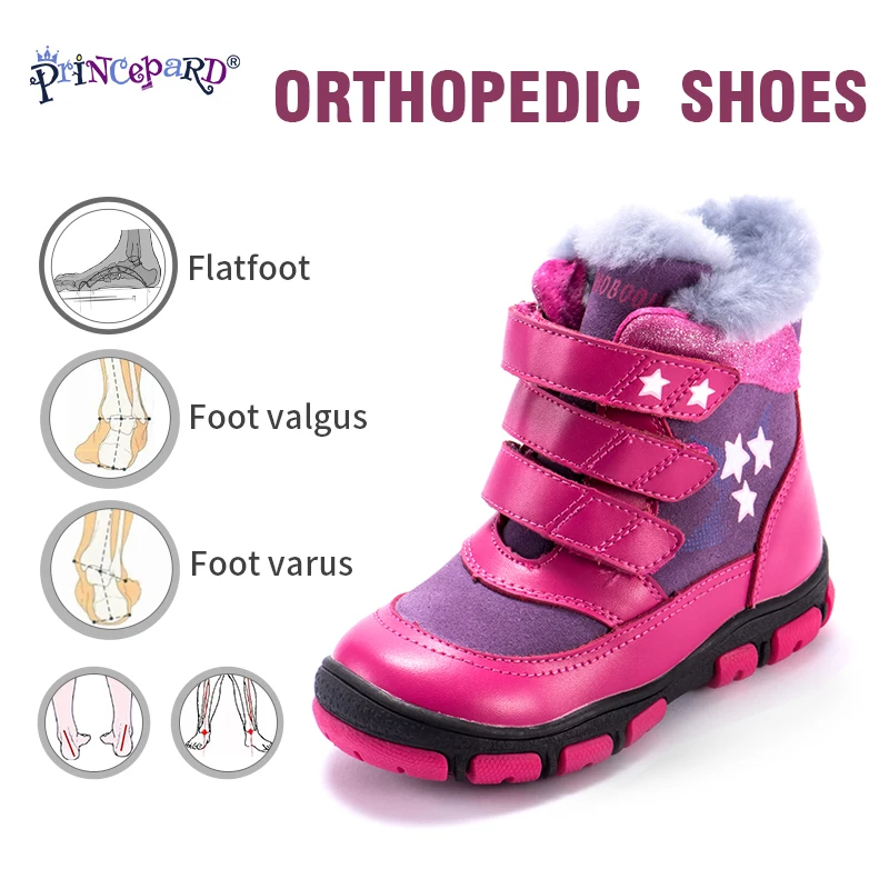 

Princepard Winter Orthopedic Shoes for Kids 100% Natural Fur Lining Genuine Leather Orhopedic Boots Boys Girls 31-36 Size