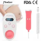 Ультразвуковой допплер JYouCare, рандомный портативный домашний монитор сердечного ритма для беременных, OLED, без излучения