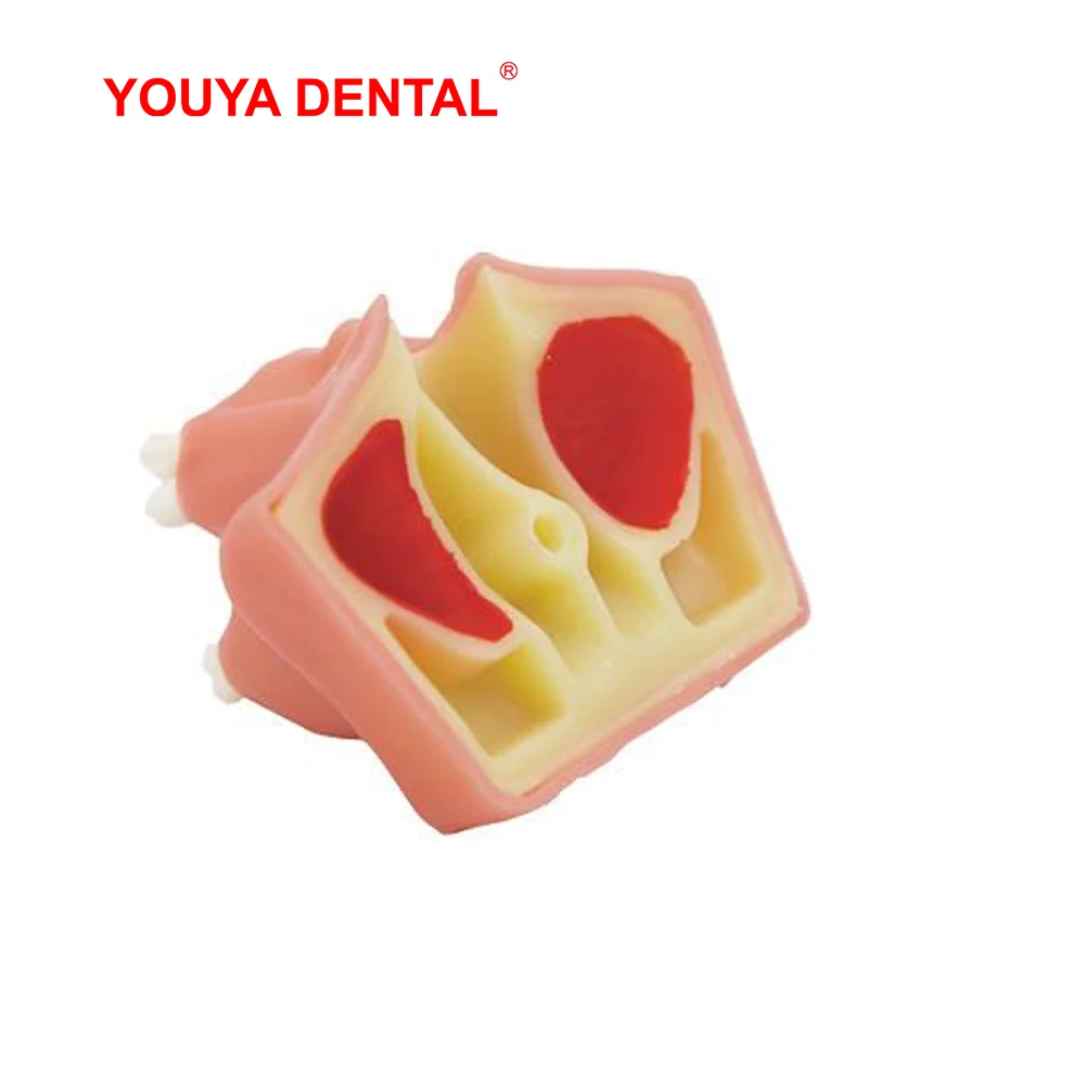 Зубная модель зубов Maxillary зубной имплантат для обучения стоматолога обучение