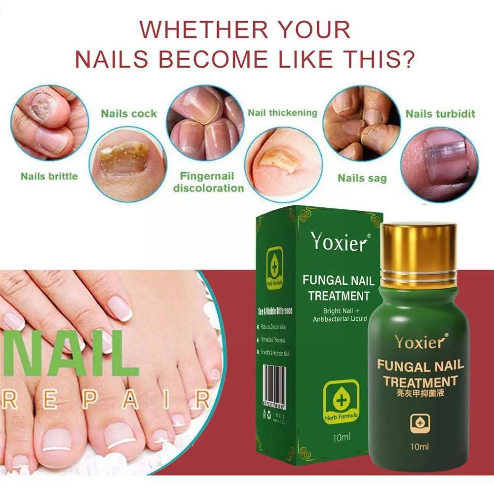 

Nail Brightening Liquid Fungal Nail Treatment Antibacterial Onychomycosis Serum Anti Care Repair Foot Infection Paronychia D8F4