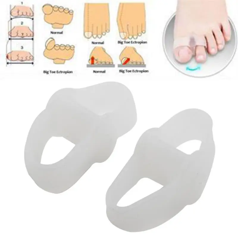 

1Pair=2Pcs Gel Silicone Bunion Corrector Big/Small Toe Separators Straightening Foot Care Bunion Adjuster Tool Hallux Valgus