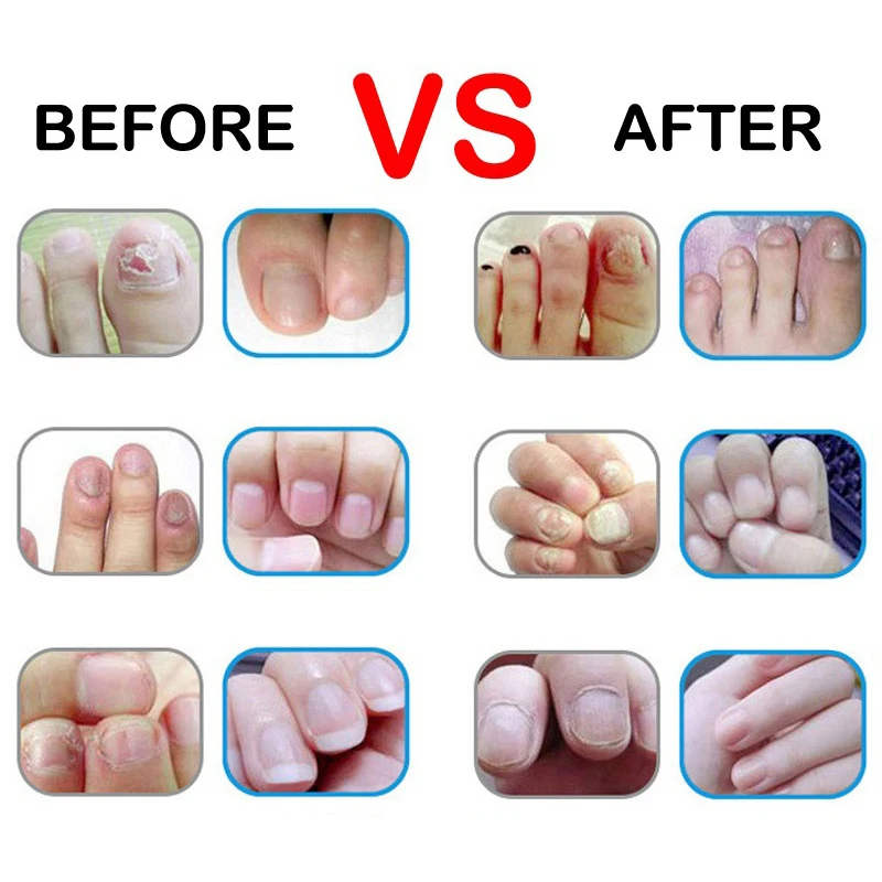 

Nail care finger edge pen nutrition oil pen finger edge Nutrient solution repair finger care liquid (random fragrance) Nail art