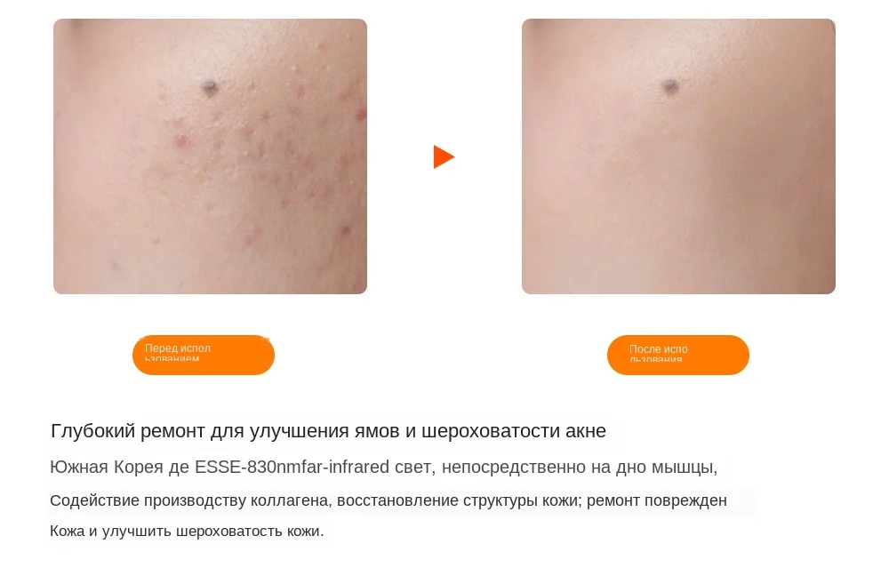 7 цветов светильник светодиодный маска для лица с омоложением кожи шеи уход за лицом Лечение Красота анти акне терапия отбеливающий инструмент