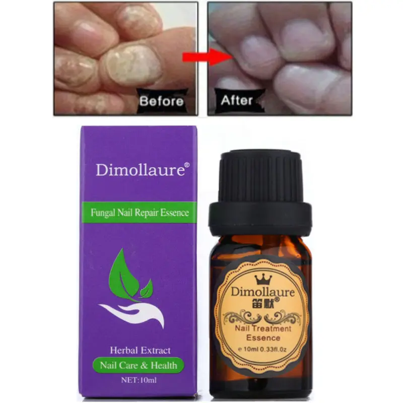 Травяная лечебная эссенция для ногтей от грибков Dimollaure удаление грибка рук и ног