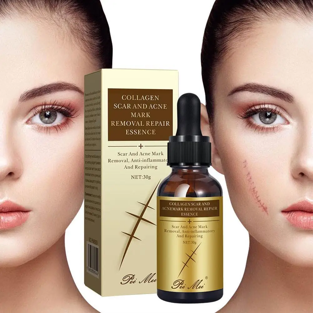 

30ml Collagen Skin Essence Skin Smoothing Imprint Repair Brighten Face Pimples Liquid Scar Stretch Removal Marks Acne Cream O9J7