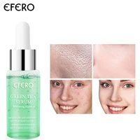 green tea acne treatment face serum whitening anti oxidation moisturizing oil control essence shrink pores nourishing skin care