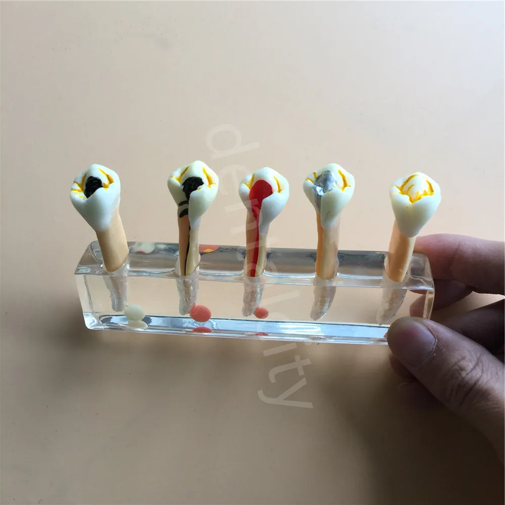 Стоматологическая 5 ступенчатая модель для лечения зубов обучения Лидер