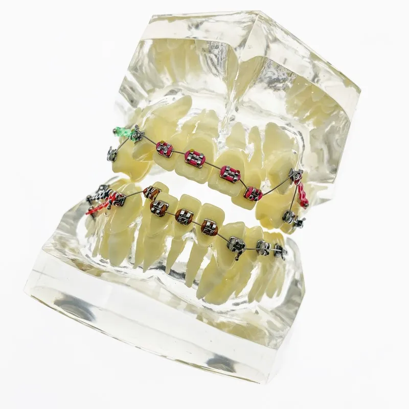 Стоматологические модели зубов используются для обучения и больничных