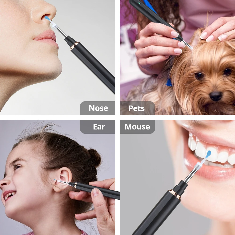 

5.0MP Visual Otoscope HD WiFi Waterproof Ear Endoscoop 3.9mm Digital Camera Ear Wax Removal Earpick with Magnetic Charge Base