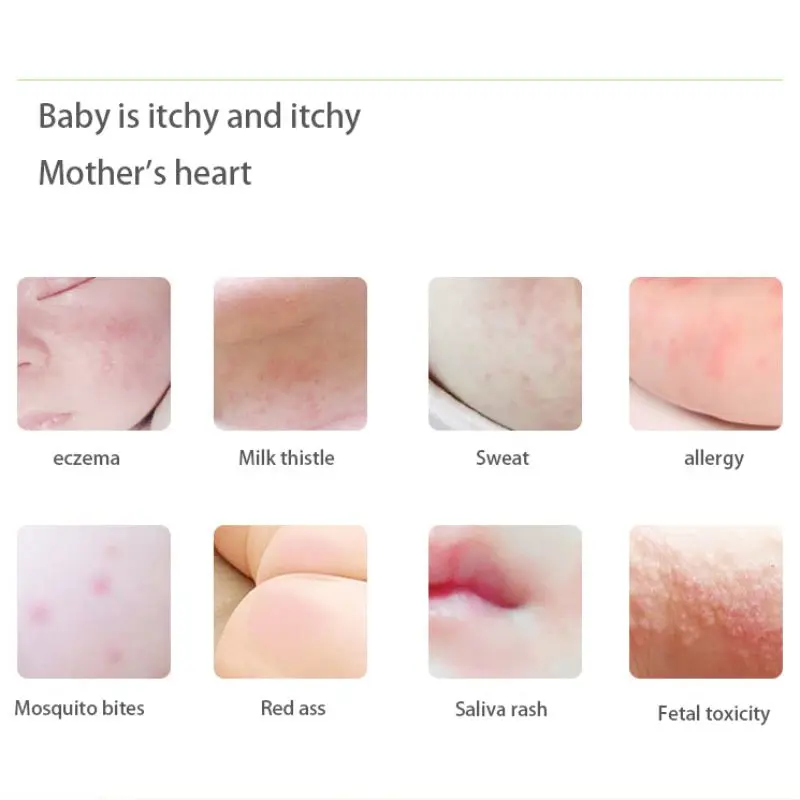 Антиприуритическая мазь Антибактериальная стерилизация снимает зуд