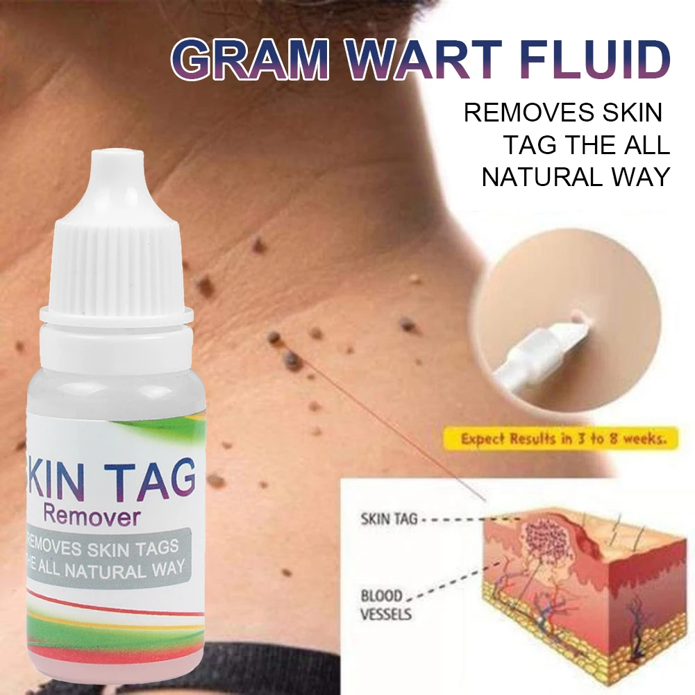 

Retail New Arrival Skin Tag And Wart Removal Serum Fast Acting Warts Treatment Solution For Flat Warts Moles Common Warts Corns