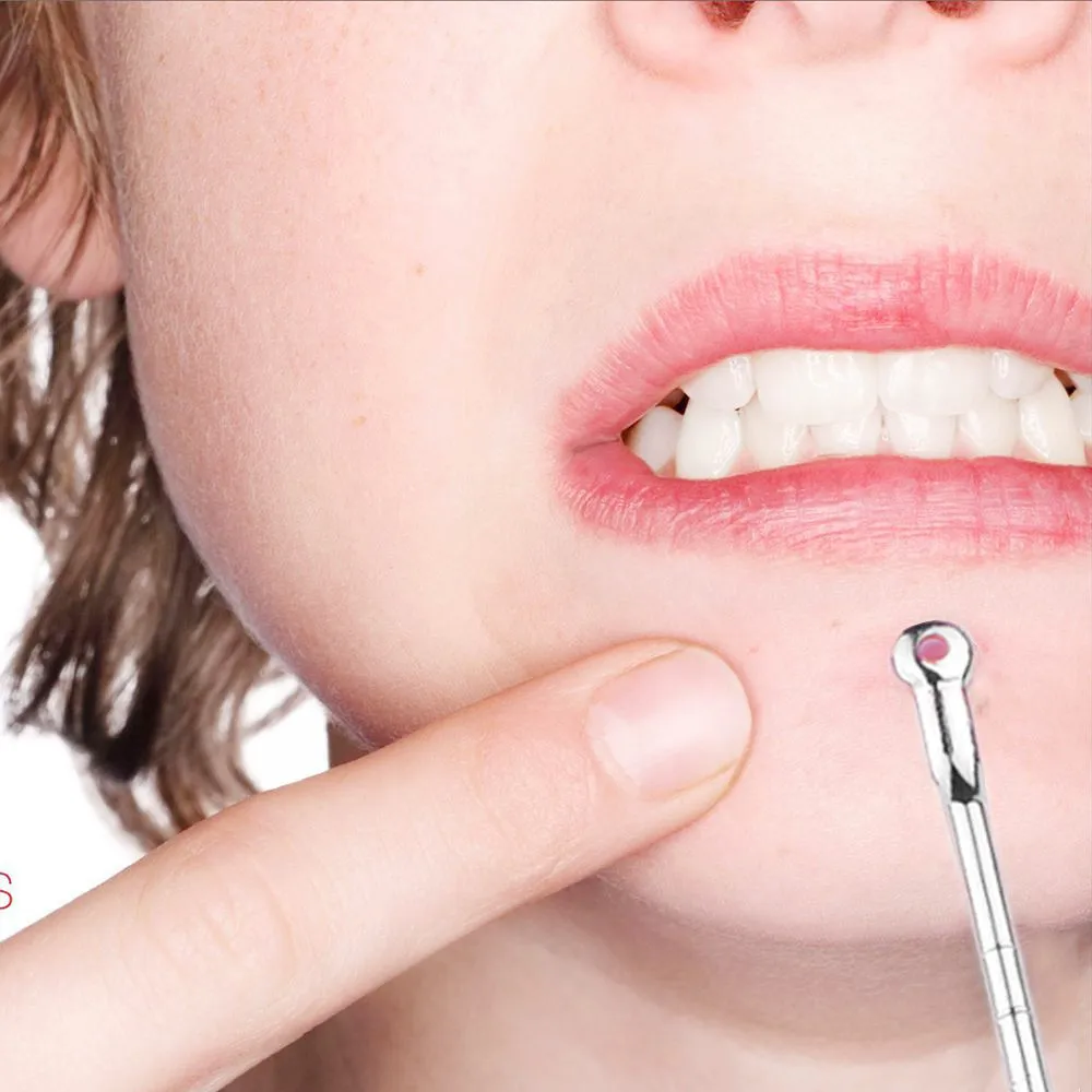4 шт./компл. Blackhead Comedone зерна дефект вакуумный экстрактор инструмент для удаления