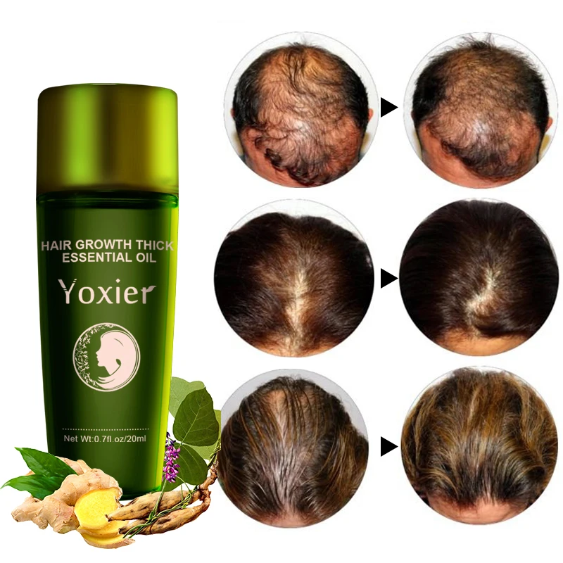 

Yoxier Herbal Hair Growth Essential Oil Shampoo Hair Care Styling Hair Loss Product Thick Fast Repair Growing Treatment Liquid