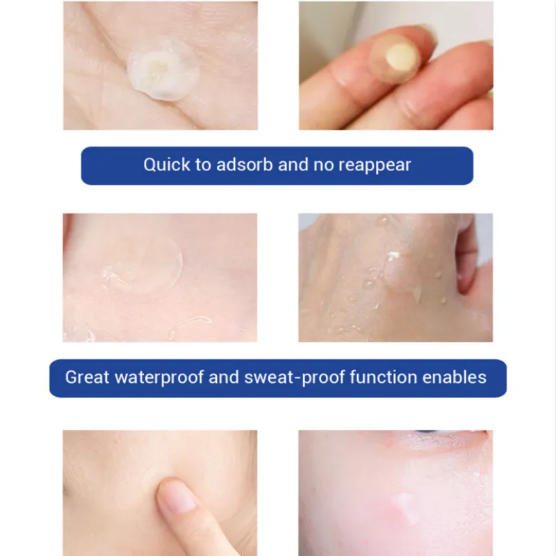 28 шт/1 лот Патчи от акне Невидимый водонепроницаемый лечение палка ночное