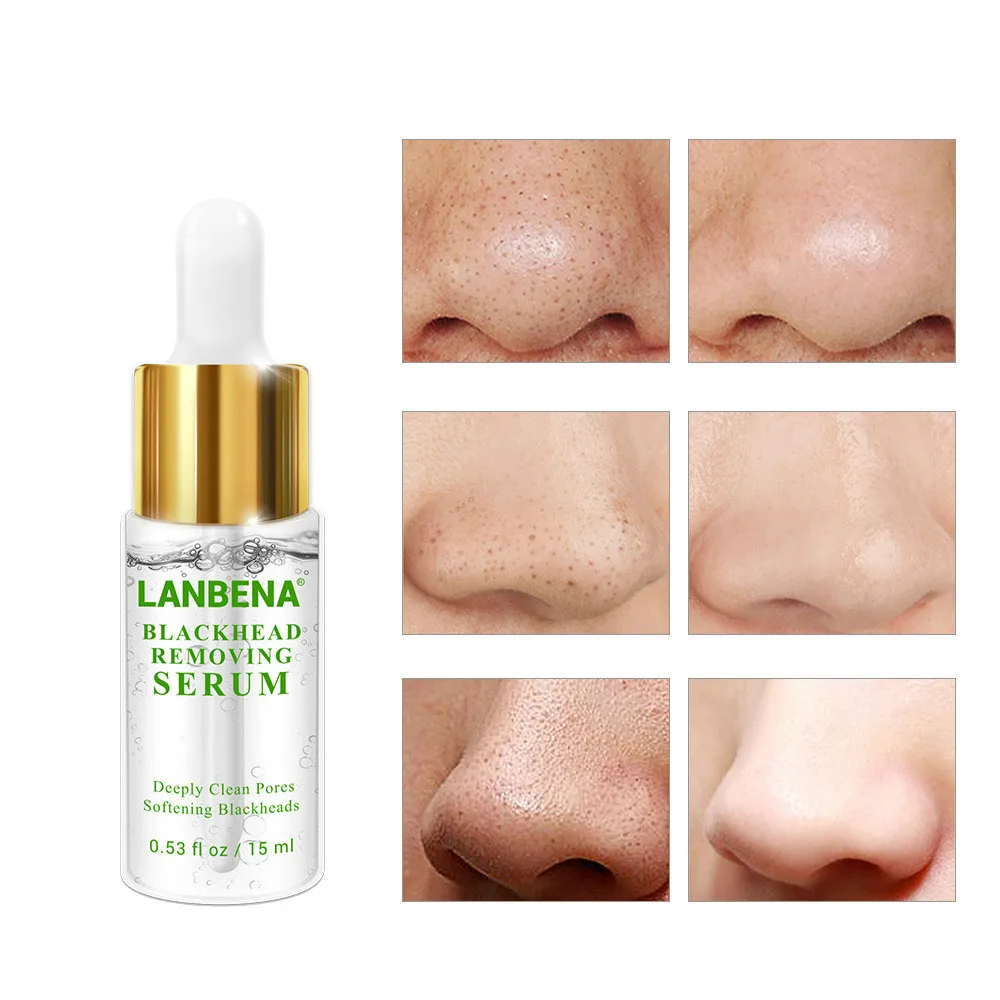 LANBENA Удаление угрей сывороточная эссенция глубокие поры акне прыщи бережное