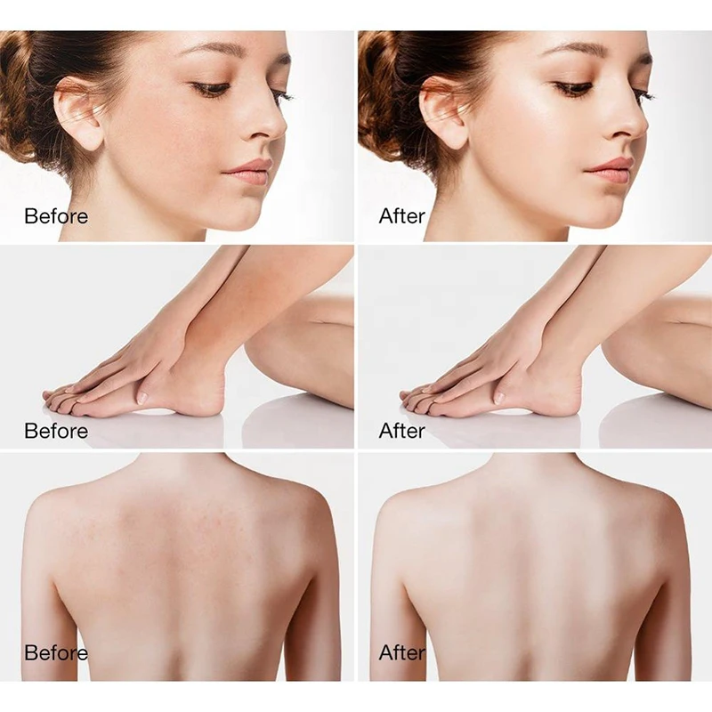 OALEN скраб для лица с бамбуковым древесным углем тела детоксикационная Природный