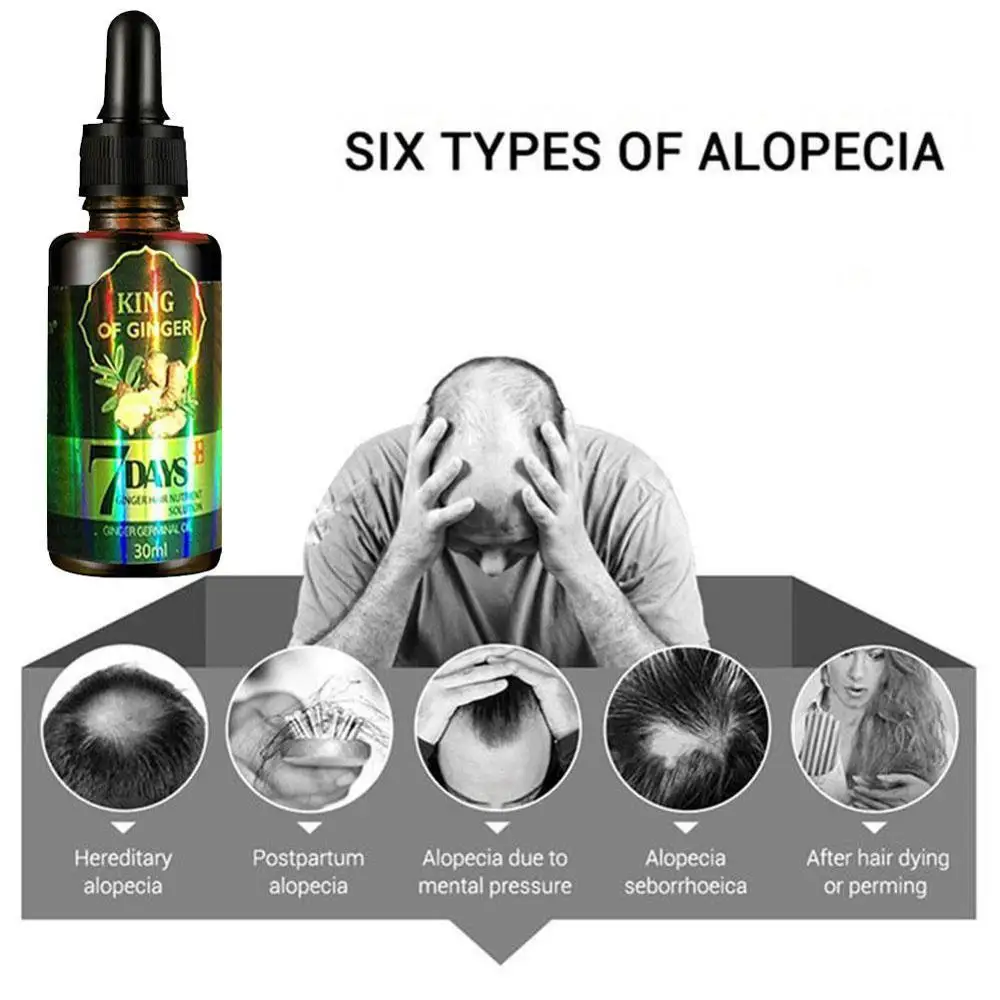 

30ml Ginger Hair Growth Nutrient Solution Hair Loss Protection Women For Men Oil Treatment Essential Hair U8H1