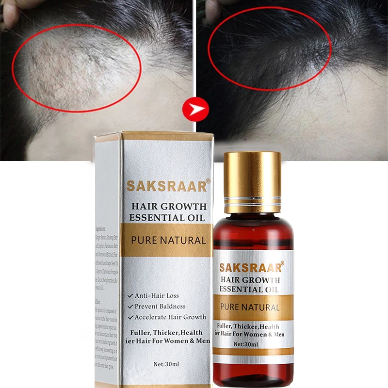 

Hair Care Hair Growth Essential Oils Essence Original Authentic 100% Hair Loss Liquid Health Care Beauty Dense Hair Growth Serum