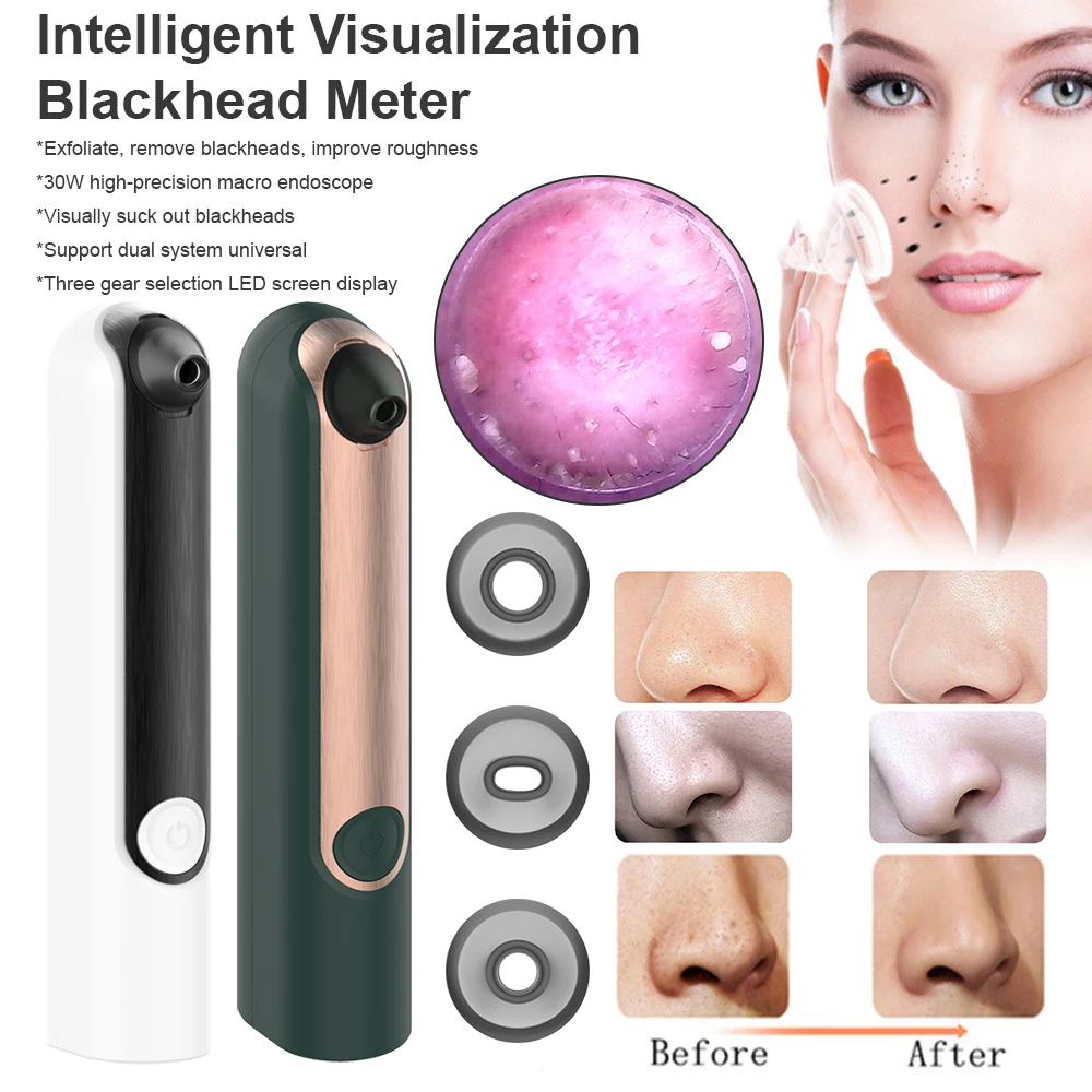 

Электрический измеритель черных точек, перезаряжаемый от Usb, 30 Вт, высокая точность, макровиализация, светодиодный экран, дисплей, три уровн...