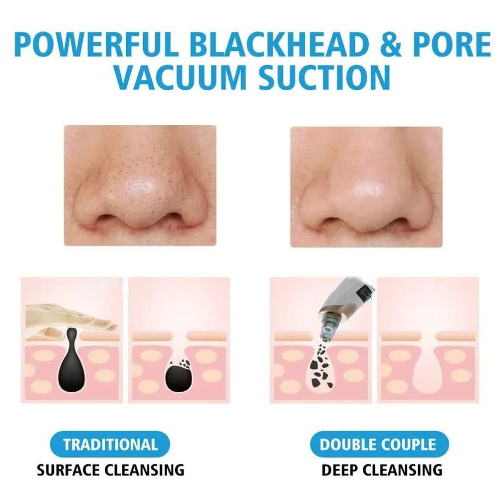 Аспиратор для черных точек HZ9 Электрический Очиститель пор вакуумный очиститель