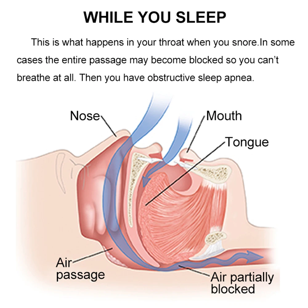 Мини Силиконовый магнитный зажим для носа против храпа и 4 шт. поднос сна защита